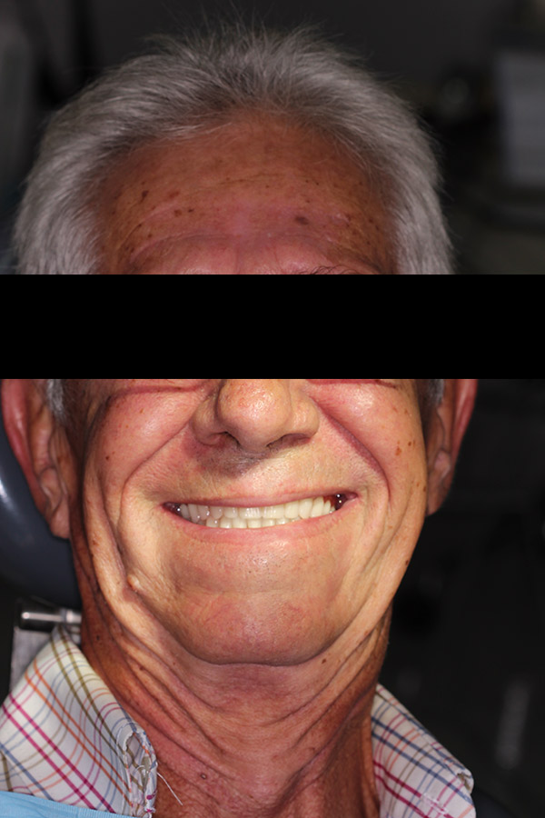 Μετά Image