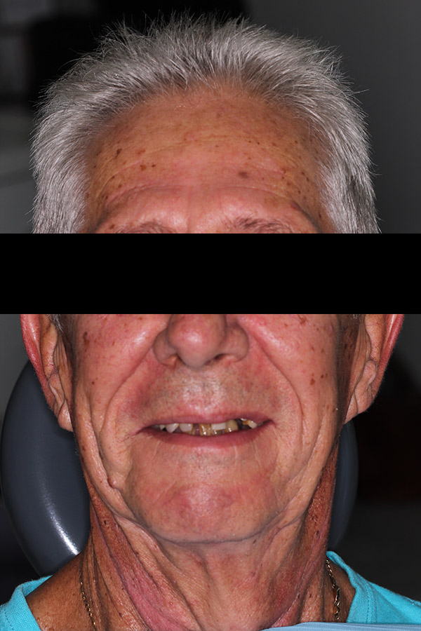 Πριν Image